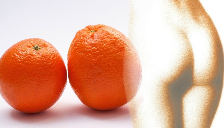 Тања Турунџиева за целулитот: За да се „измазни кората од портокал“, треба да се смени исхраната, да се вежба и да се намали стресот